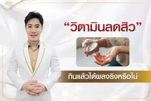 วิตามินลดสิว กินแล้วได้ผลจริงหรือไม่