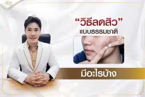 วิธีลดสิวแบบธรรมชาติ มีอะไรบ้าง