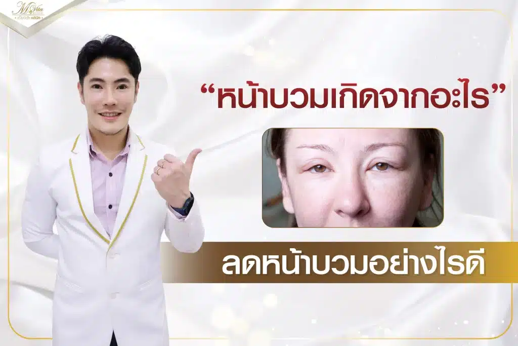 หน้าบวมเกิดจากอะไร ลดหน้าบวมอย่างไรดี
