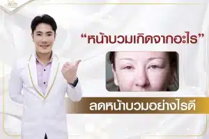หน้าบวมเกิดจากอะไร ลดหน้าบวมอย่างไรดี