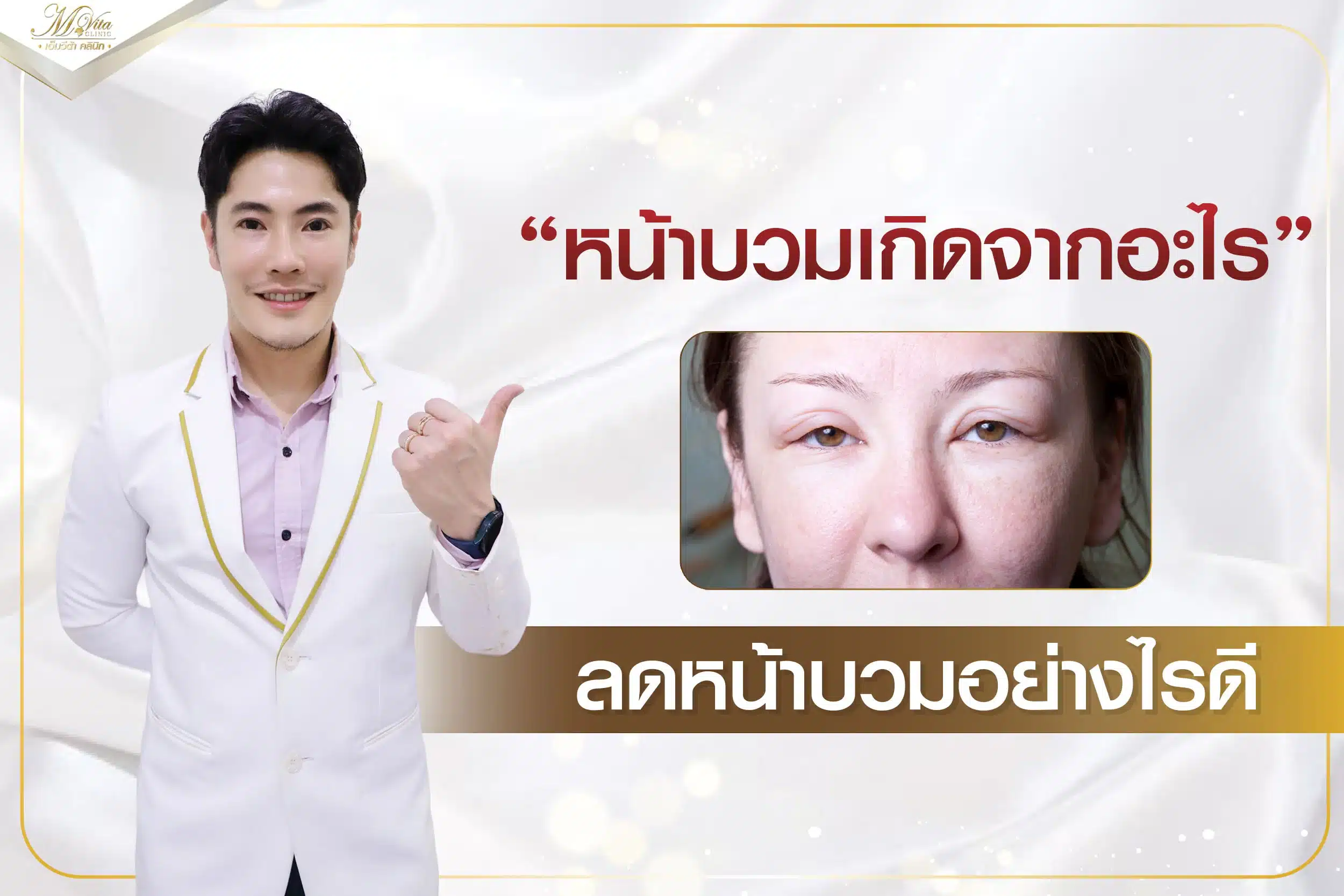 หน้าบวมเกิดจากอะไร ลดหน้าบวมอย่างไรดี