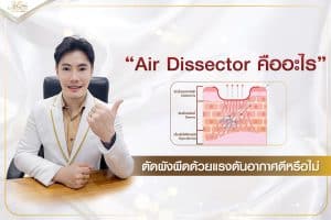 คลินิกรักษาหลุมสิว