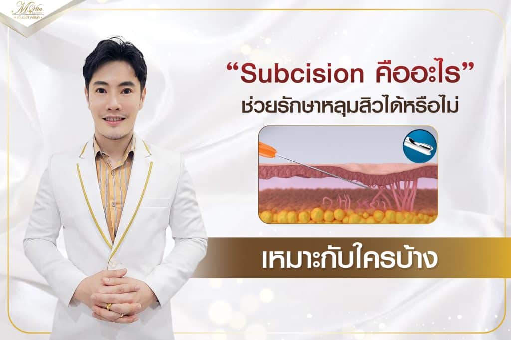 คลินิกรักษาหลุมสิว