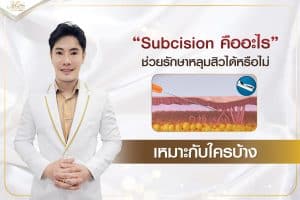 คลินิกรักษาหลุมสิว