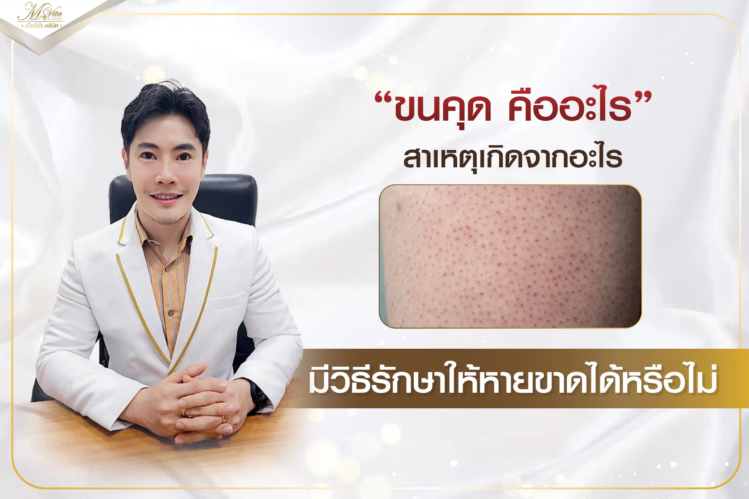 คลินิกรักษาหลุมสิว