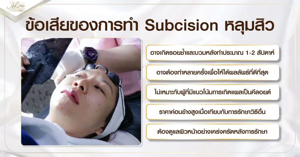 ข้อเสียของการทำ Subcision หลุมสิว
