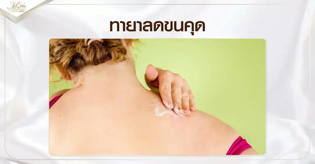 ทายาลดขนคุด