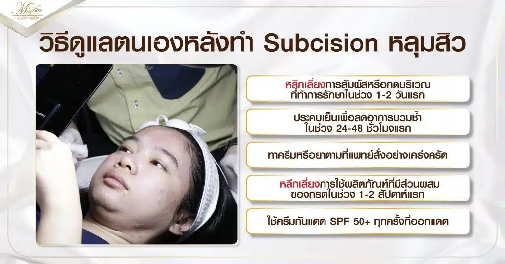 วิธีดูแลตนเองหลังทำ Subcision หลุมสิว