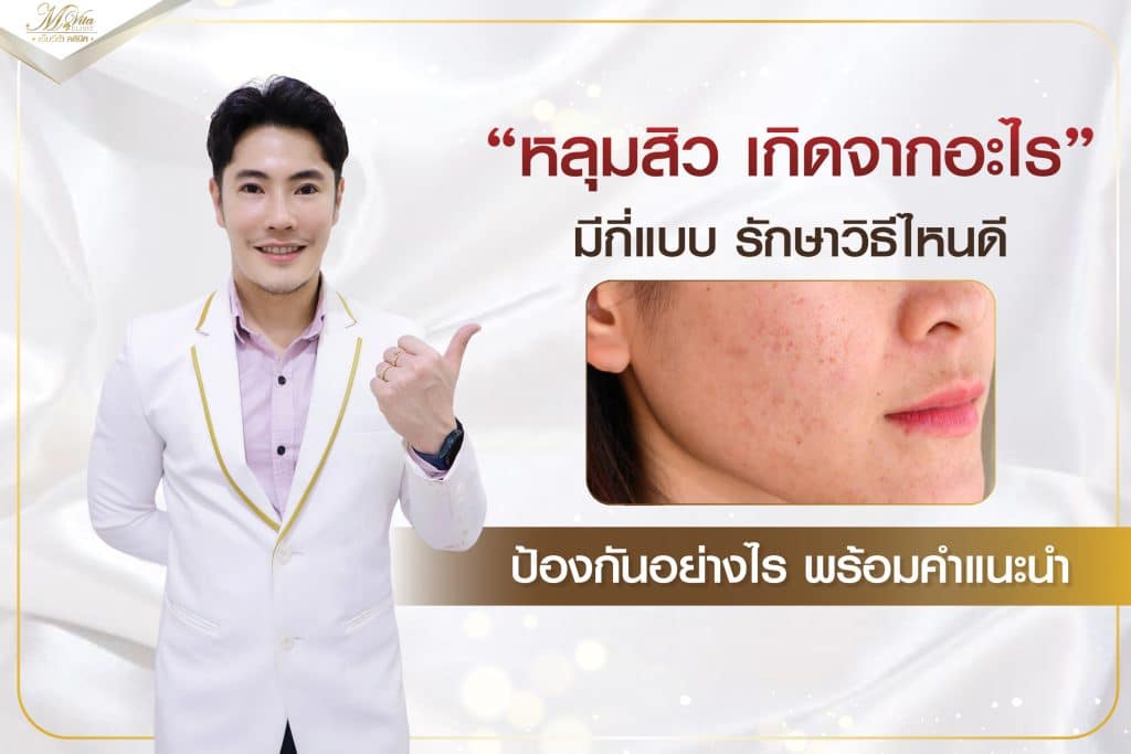 คลินิกรักษาหลุมสิว