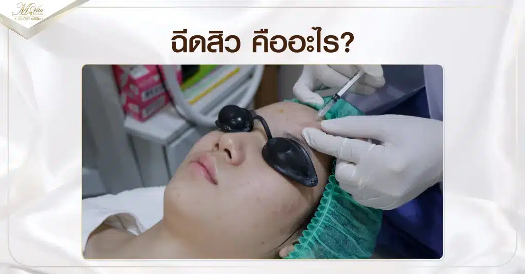 ฉีดสิว คืออะไร