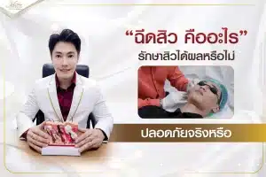 ฉีดสิว คืออะไร รักษาสิวได้ผลหรือไม่ ปลอดภัยจริงหรือ