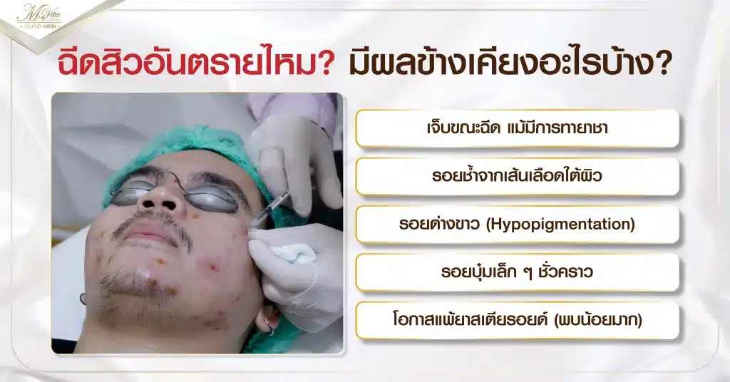 ฉีดสิวอันตรายไหม มีผลข้างเคียงอะไรบ้าง
