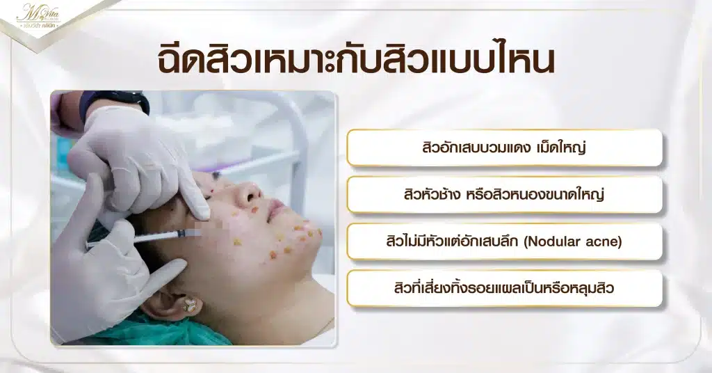 ฉีดสิวเหมาะกับสิวแบบไหน
