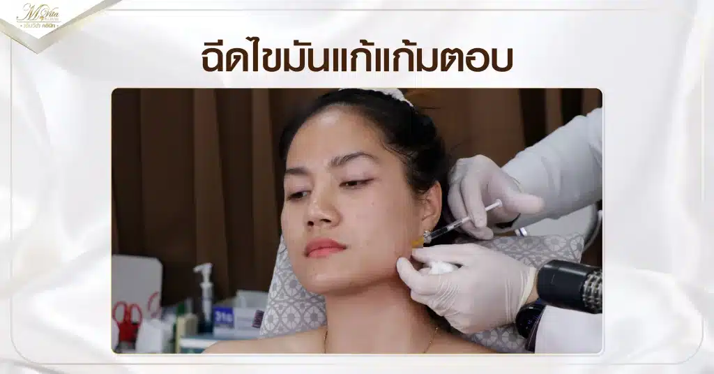 ฉีดไขมันแก้แก้มตอบ
