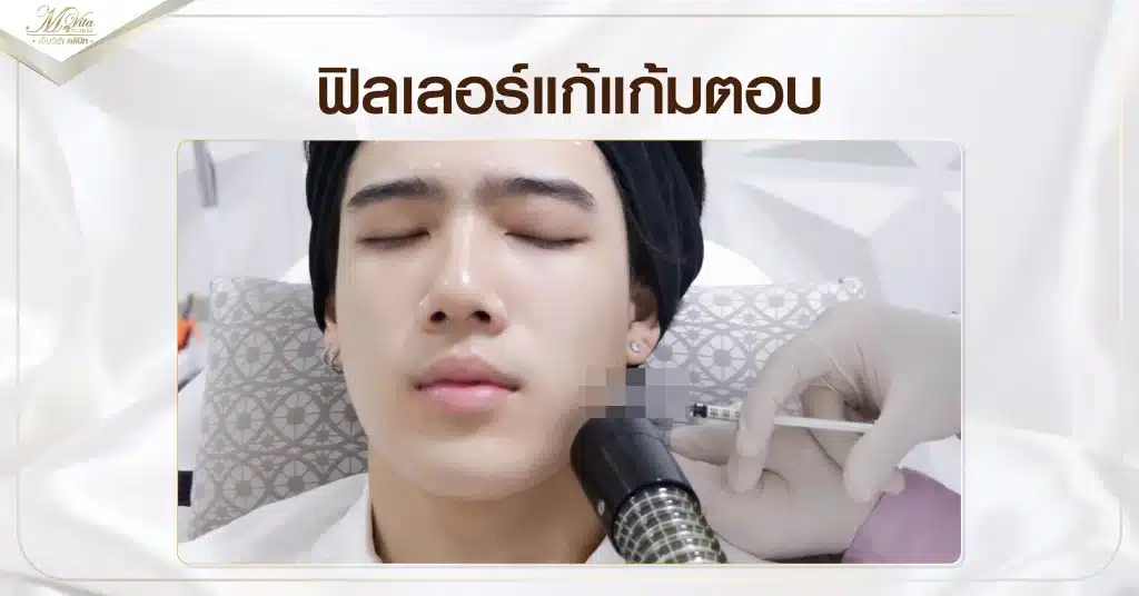 ฟิลเลอร์แก้แก้มตอบ