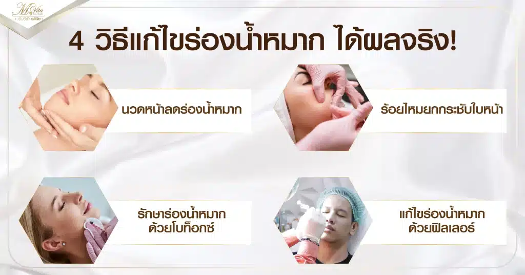 ร่องน้ําหมากลึกเกิดจากอะไร