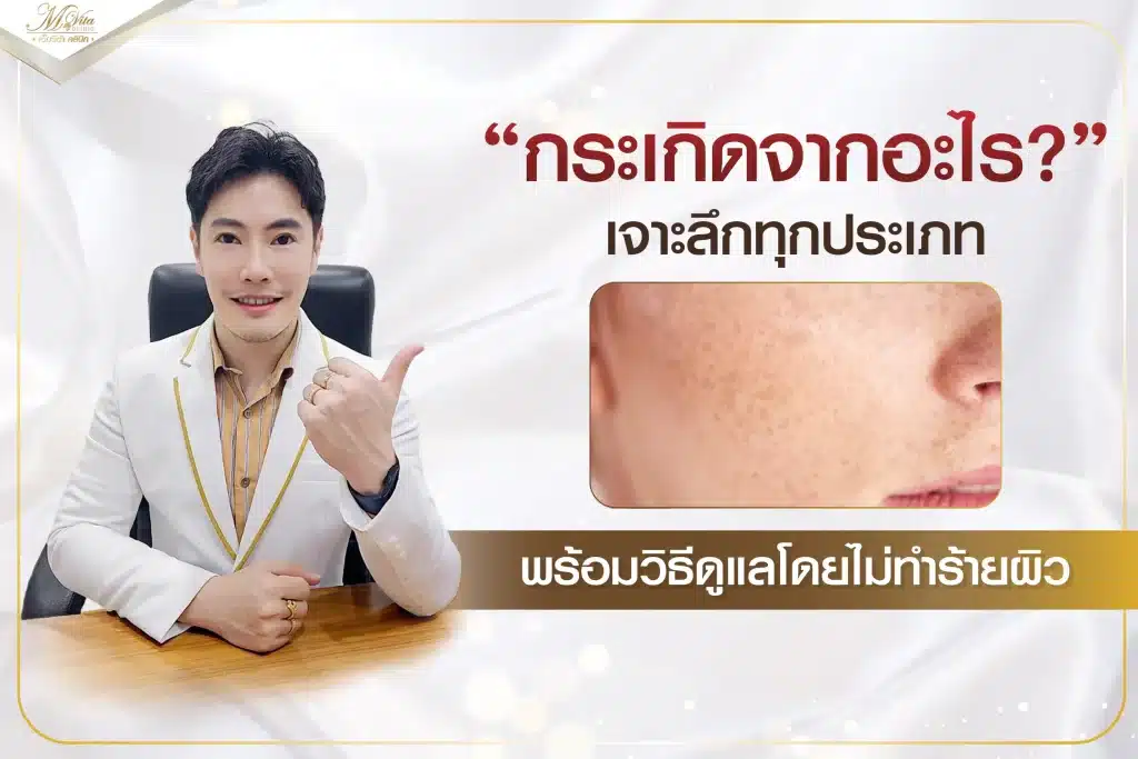กระ คืออะไร
