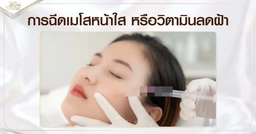 ฉีดเมโสรักษาฝ้า
