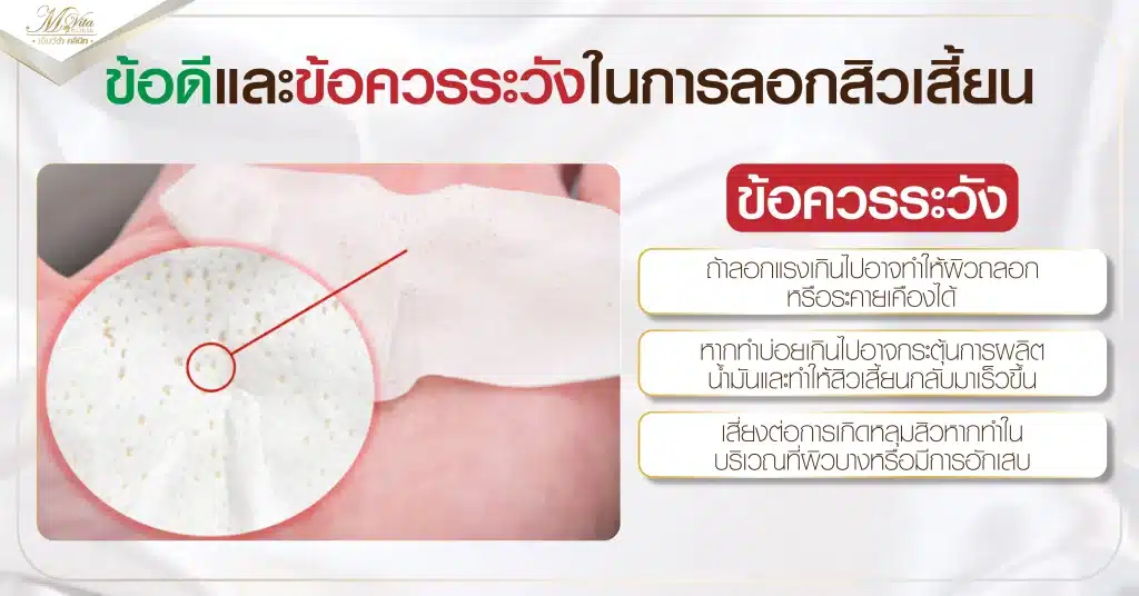 ข้อดีและข้อควรระวังในการลอกสิวเสี้ยน (ข้อควรระวัง)