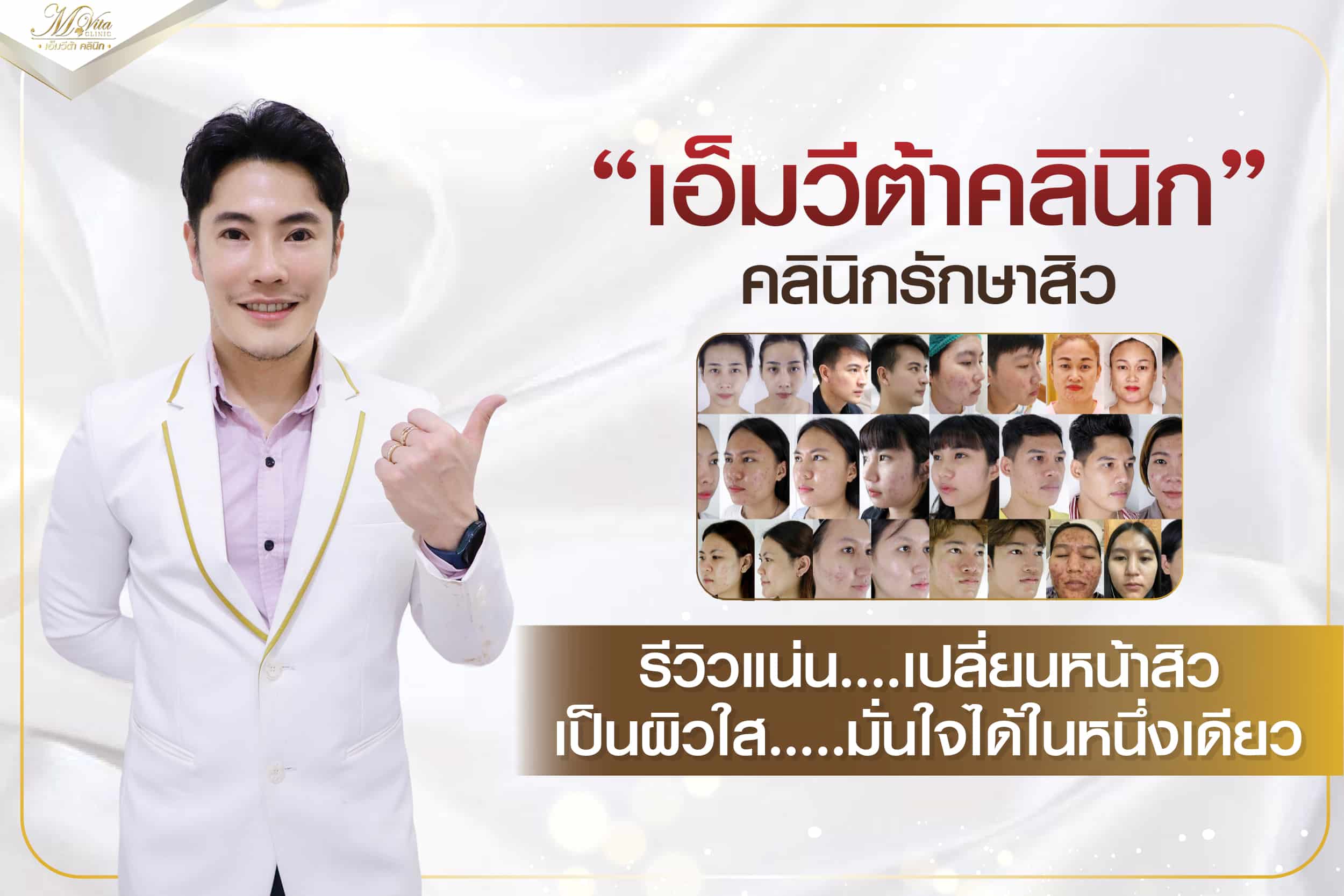 เอ็มวีต้าคลินิก คลินิกรักษาสิว รีวิวแน่น…เปลี่ยนหน้าสิว เป็นผิวใส….มั่นใจได้ในหนึ่งเดียว