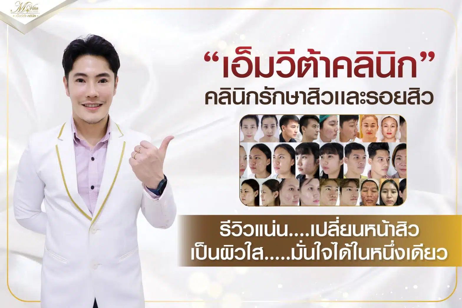 เอ็มวีต้าคลินิก คลินิกรักษาสิวและรอยสิว รีวิวแน่น…เปลี่ยนหน้าสิว เป็นผิวใส….มั่นใจได้ในหนึ่งเดียว