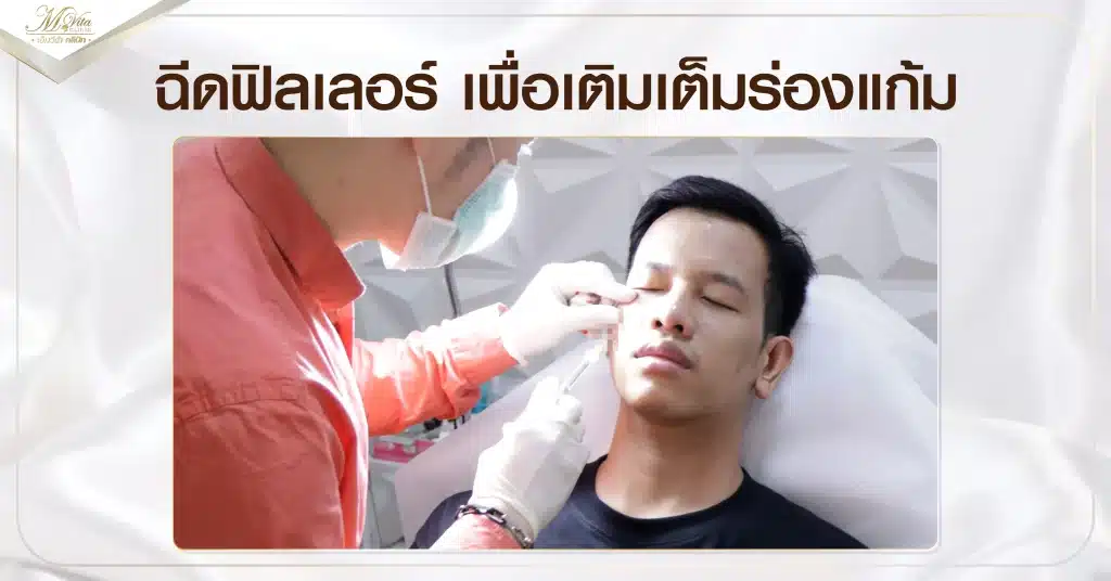 ฉีดฟิลเลอร์ เพื่อเติมเต็มร่องแก้ม