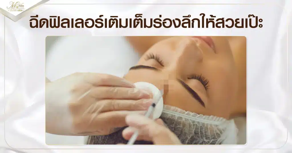 ฉีดฟิลเลอร์เติมเต็มร่องลึกให้สวยเป๊ะ