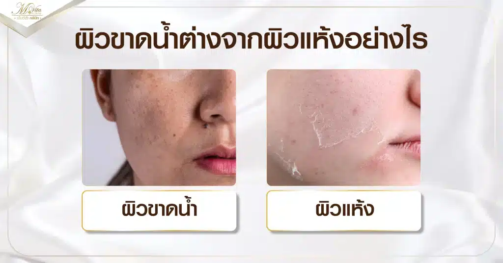 ผิวขาดน้ำต่างจากผิวแห้งอย่างไร