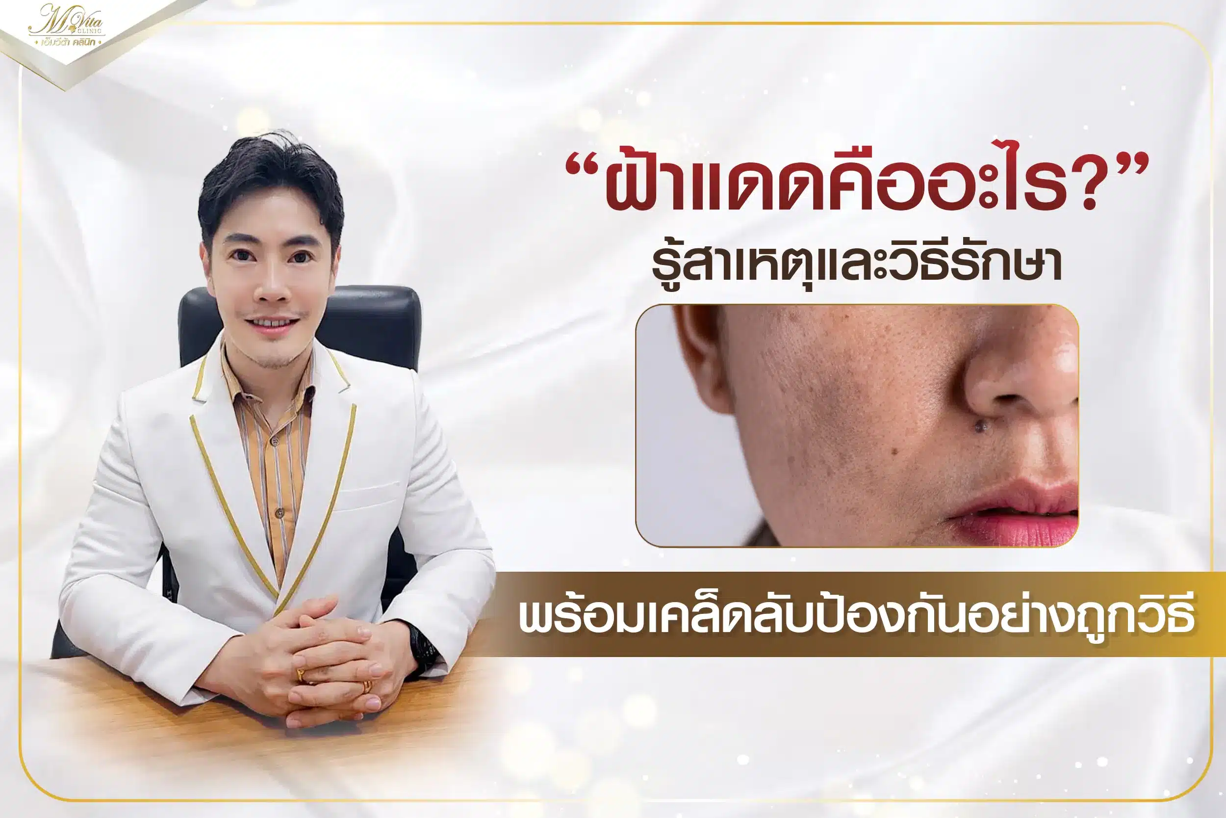 ฝ้าแดด คืออะไร