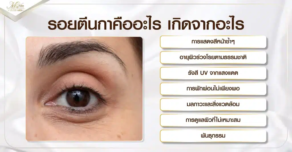รอยตีนกาคืออะไร เกิดจากอะไร