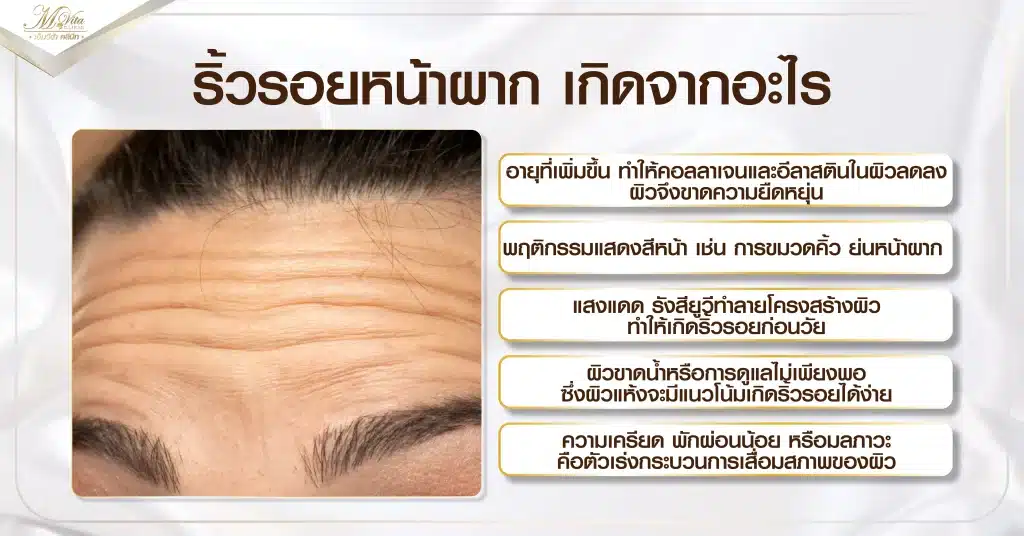 ริ้วรอยหน้าผาก เกิดจากอะไร