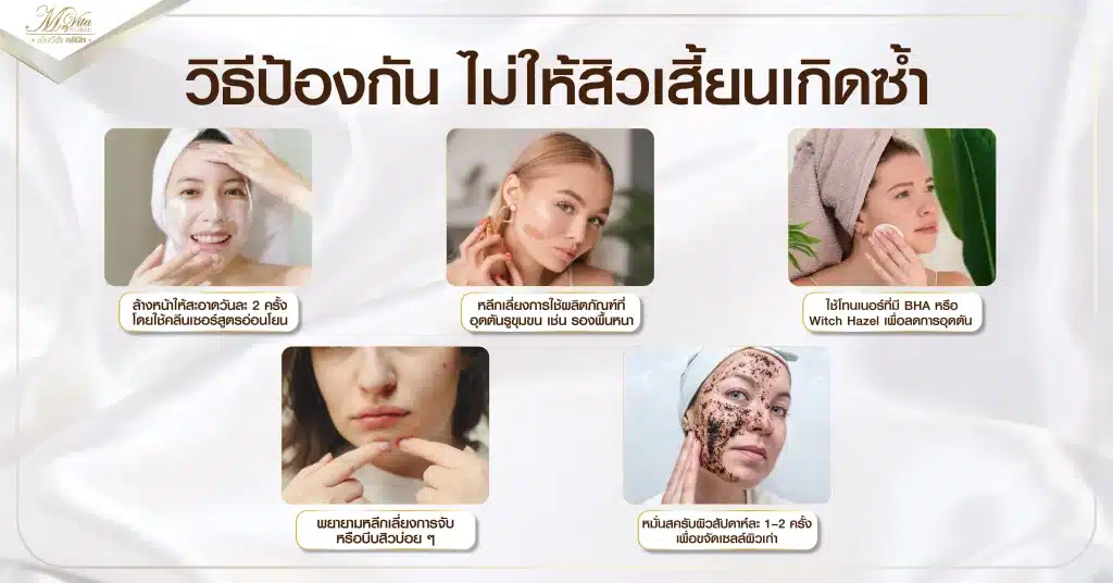 วิธีป้องกัน ไม่ให้สิวเสี้ยนเกิดซ้ำ