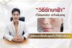 วิธีรักษาฝ้า