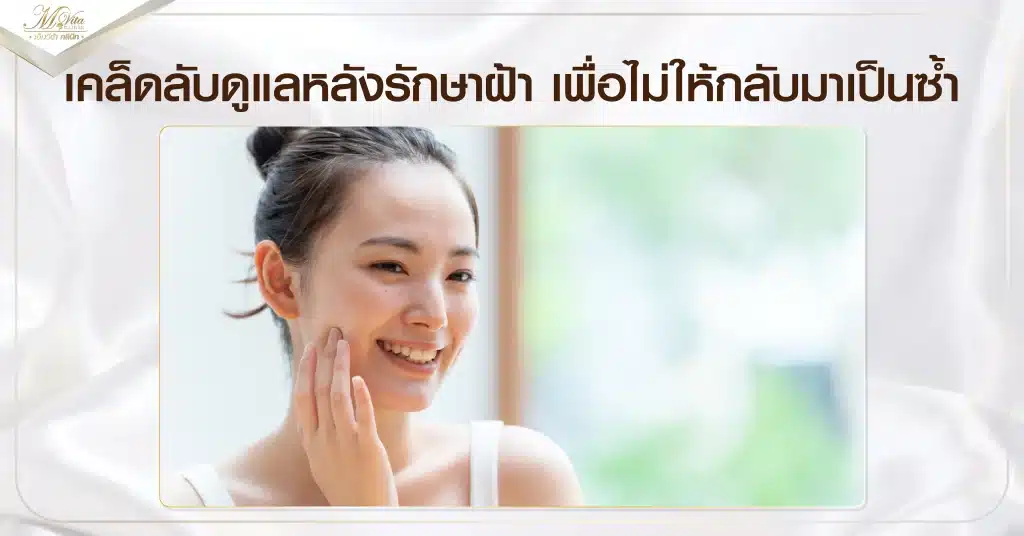 รักษาฝ้า กระ
