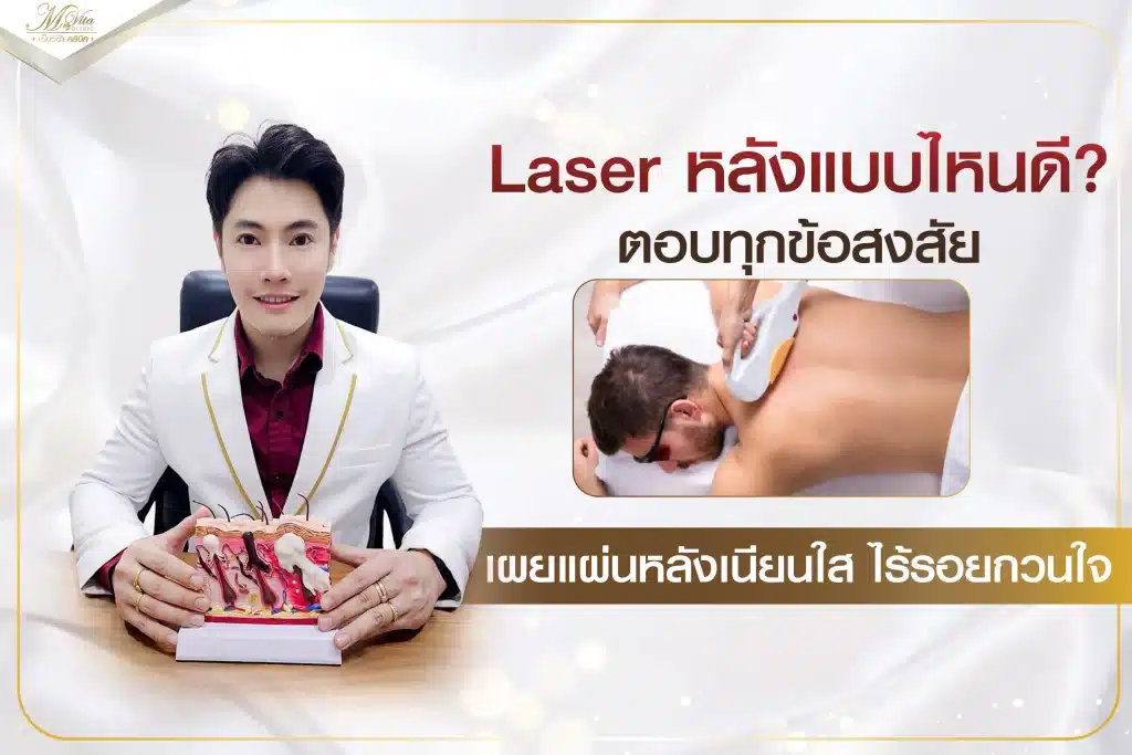 Laser หลังแบบไหนดี