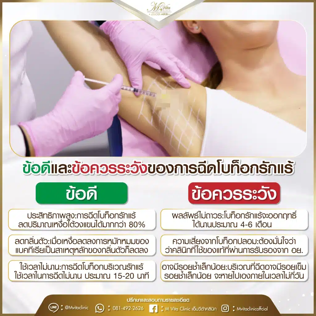 ข้อดี-ข้อควรระวังของการฉีดโบท็อกรักแร้