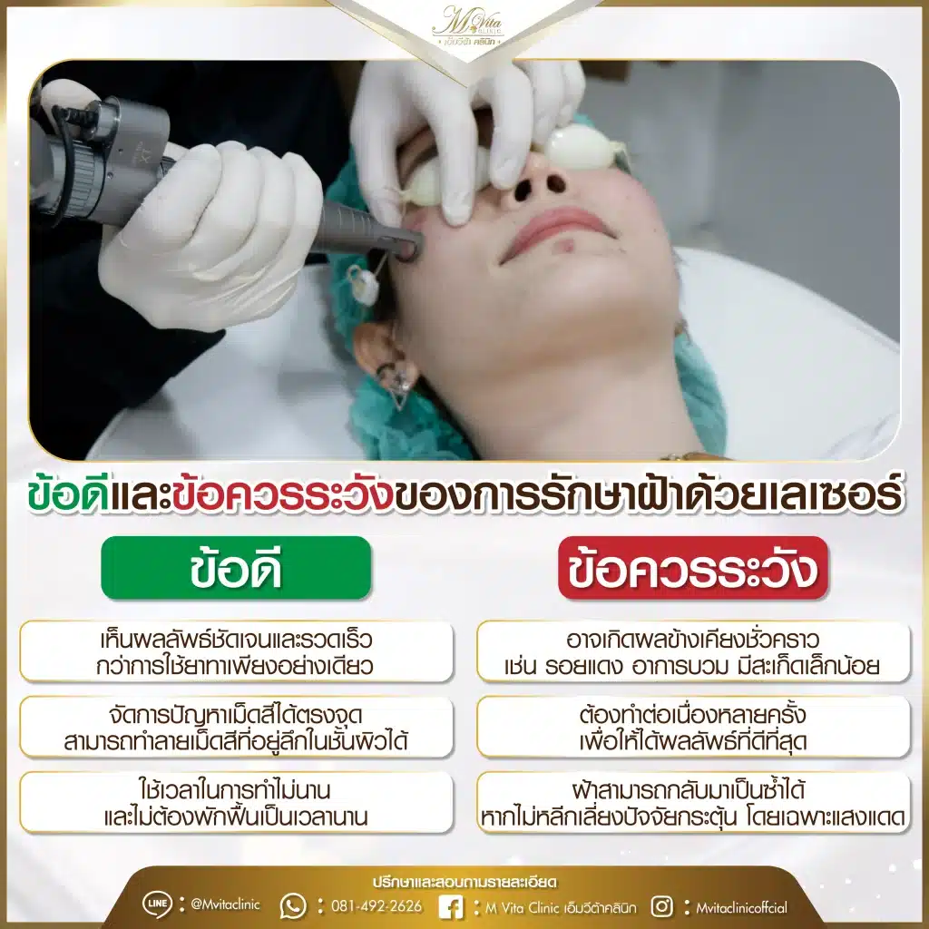 ข้อดีและข้อควรระวังของการรักษาฝ้าด้วยเลเซอร์