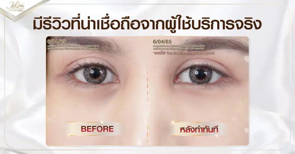 มีรีวิวที่น่าเชื่อถือจากผู้ใช้บริการจริง