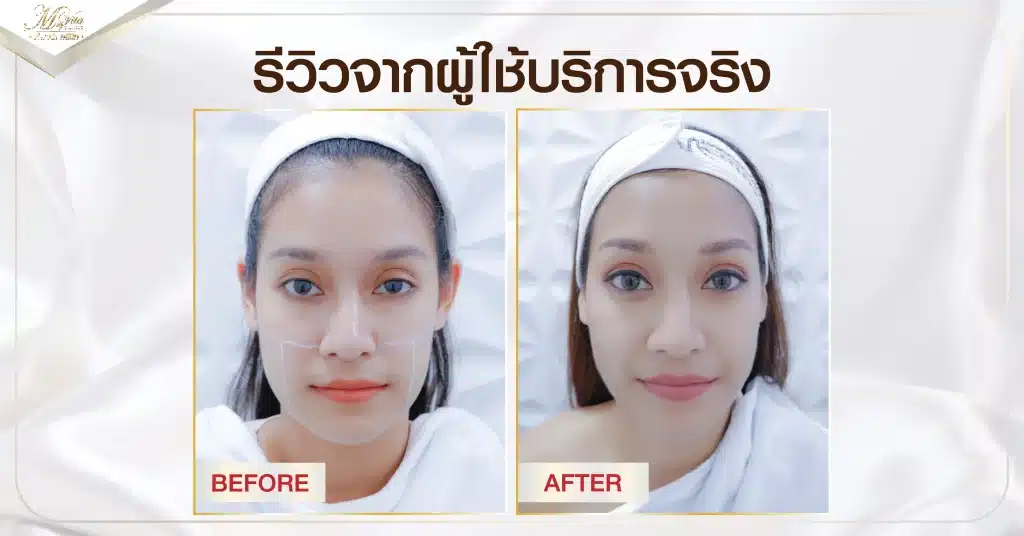 4. รีวิวจากผู้ใช้บริการจริง