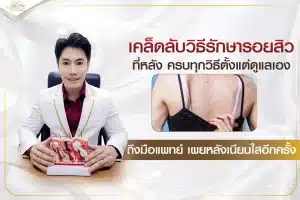 เคล็ดลับวิธีรักษารอยสิวที่หลัง