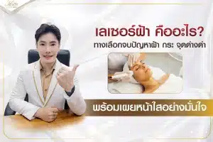 เลเซอร์ฝ้า