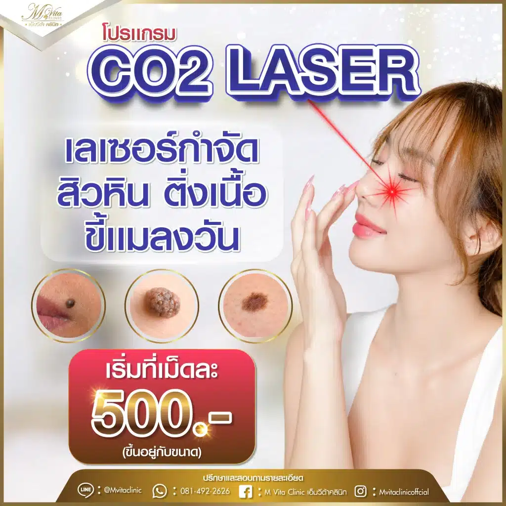 โปรแกรม CO2 Laser ราคาเท่าไหร่?