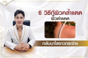 คลินิกรักษาหลุมสิว