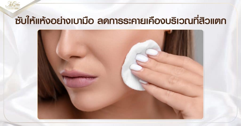 ซับให้แห้งอย่างเบามือ ลดการระคายเคืองบริเวณที่สิวแตก