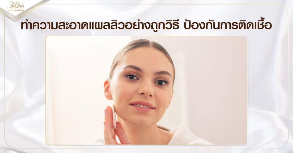 ทำความสะอาดแผลสิวอย่างถูกวิธี ป้องกันการติดเชื้อ