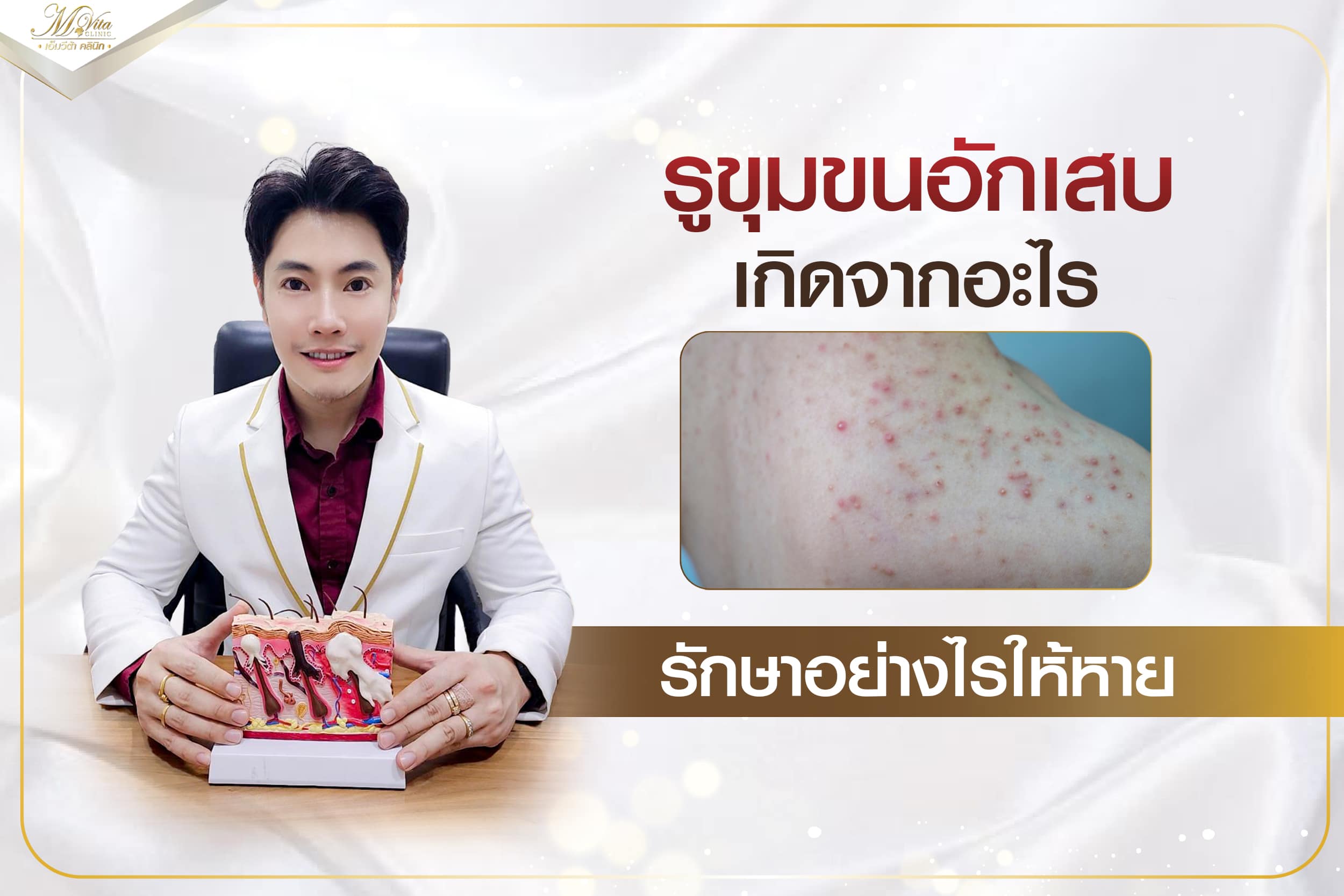 คลินิกรักษาหลุมสิว