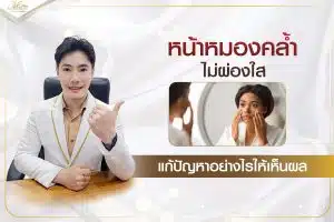 คลินิกรักษาหลุมสิว