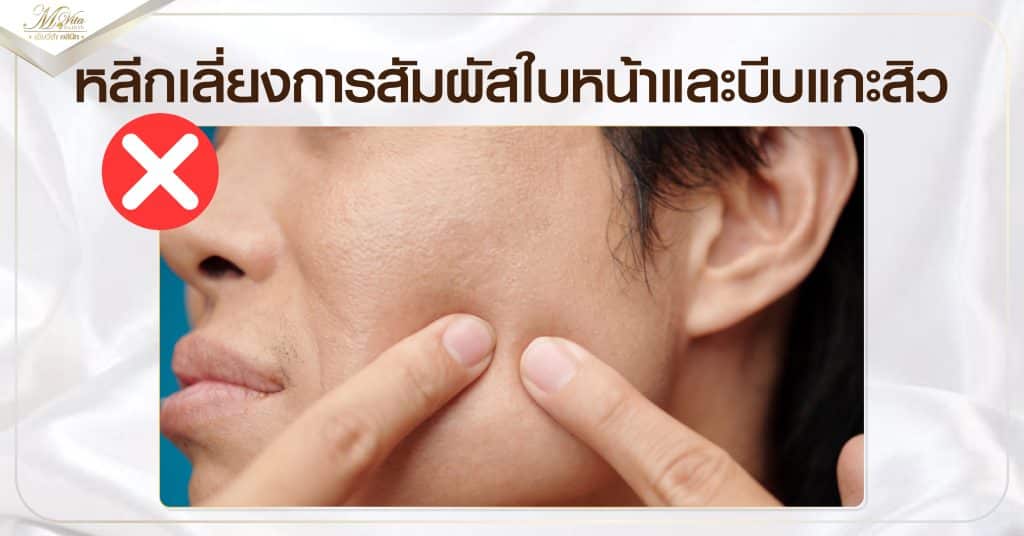 หลีกเลี่ยงการสัมผัสใบหน้าและบีบแกะสิว