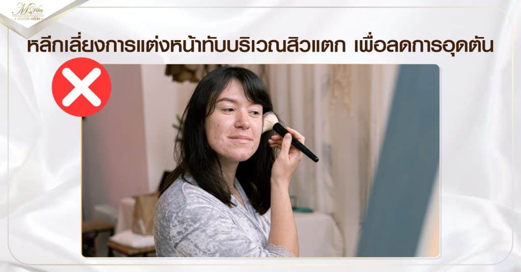 หลีกเลี่ยงการแต่งหน้าทับบริเวณสิวแตก เพื่อลดการอุดตัน