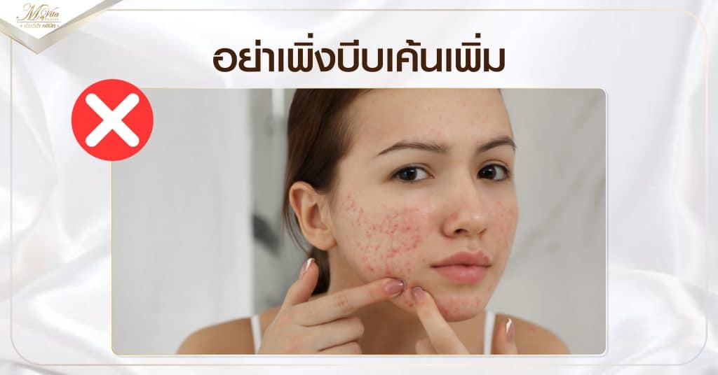 อย่าเพิ่งบีบเค้นเพิ่ม